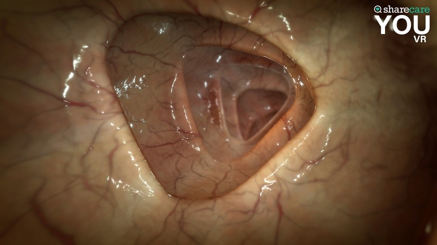 Sharecare YOU VRPCƽ桷